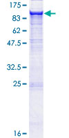 12.5% SDS-PAGE Stained with Coomassie Blue